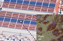 Adipose analysis on microfluidic chips